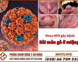 Virus HPV là nguyên nhân gây bệnh sùi mào gà